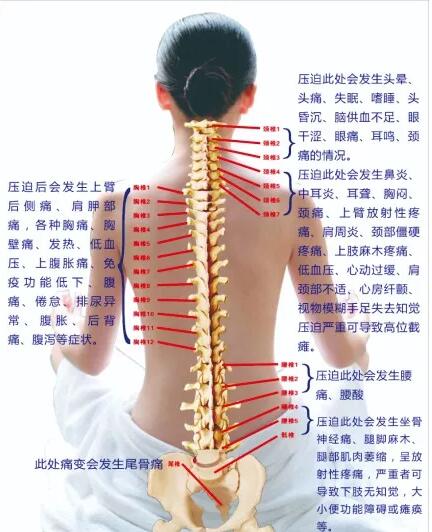保護(hù)腰椎—示范腰椎保健操，趕快收藏吧