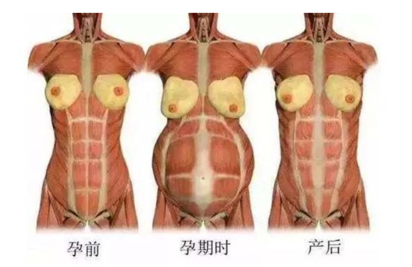 產(chǎn)后媽媽骨盆修復(fù)――帶你回到完美身材！