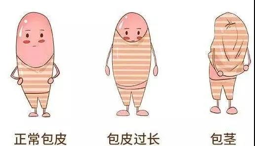【保山安利醫(yī)院】家長速看！暑期包皮手術(shù)預(yù)約正當(dāng)時！
