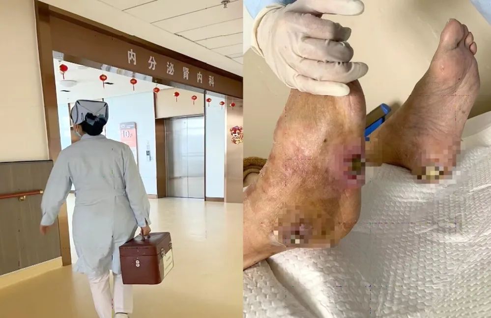 【保山安利醫(yī)院】傷口治療一站式，健康生活零距離！
